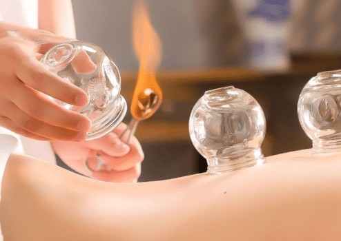 Cupping Ventouses Chaudes