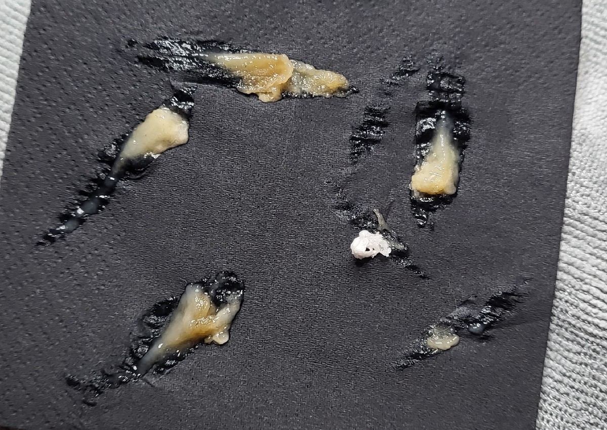 Elim Express Heel Peel