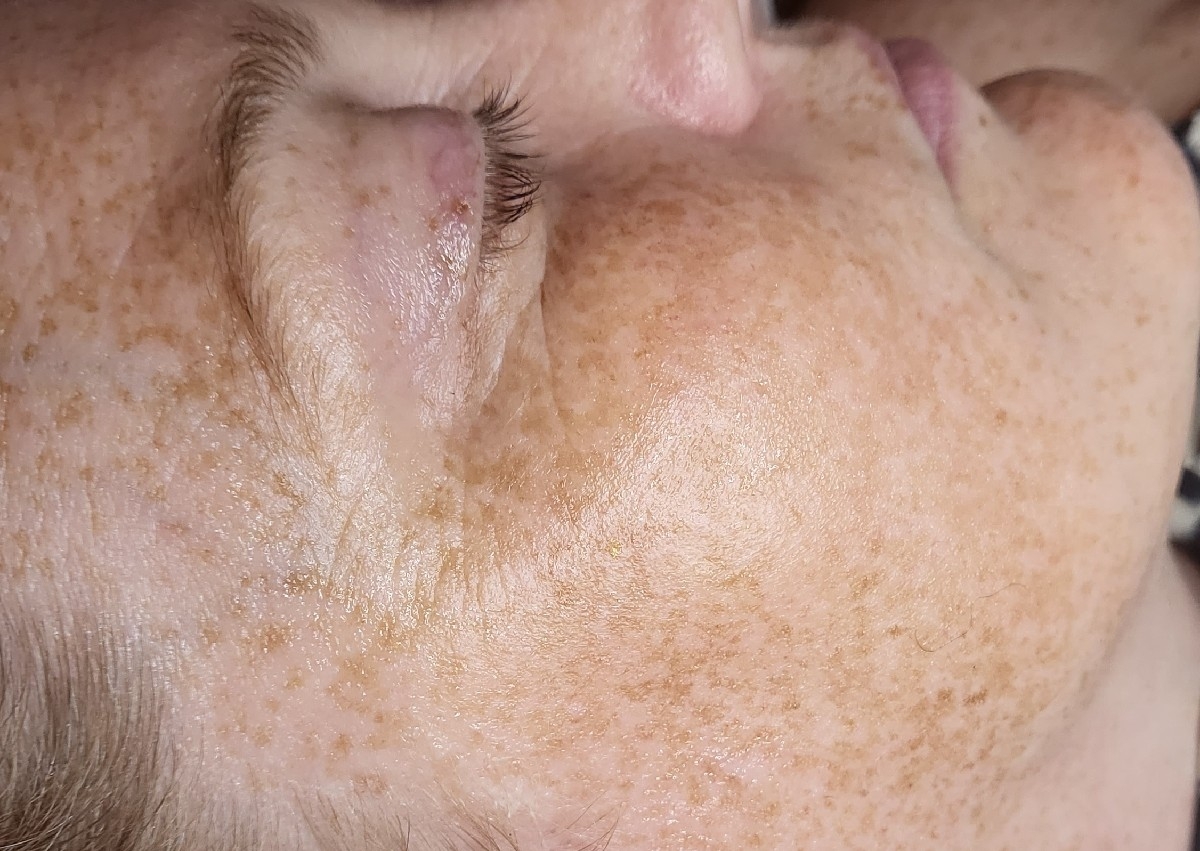 Deluxe Dermaplaning Facial