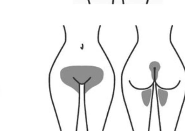 Brazilian wax
