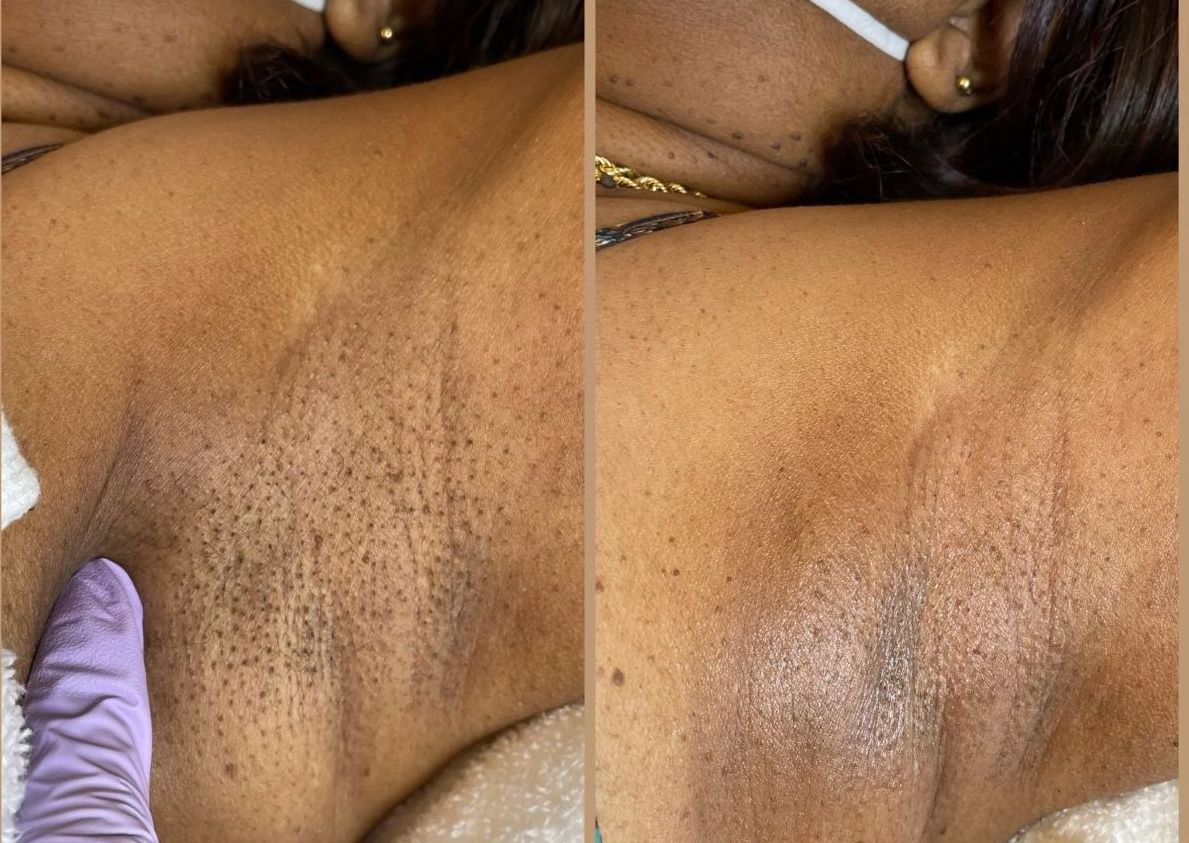 Underarm wax