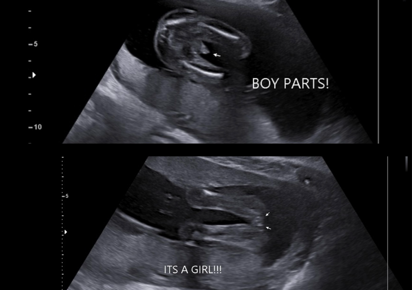 Pink Or Blue (14+ weeks) 