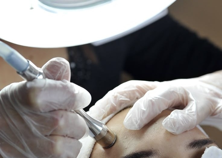 Peeling cavitațional + Microdermabraziune + terapie LED 