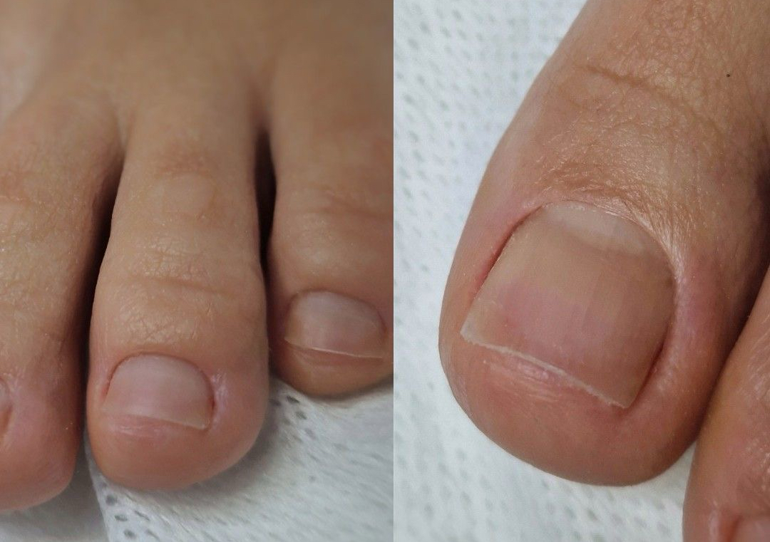 Scos semi+pedichiura clasica + tratament