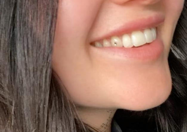 Tooth gems 