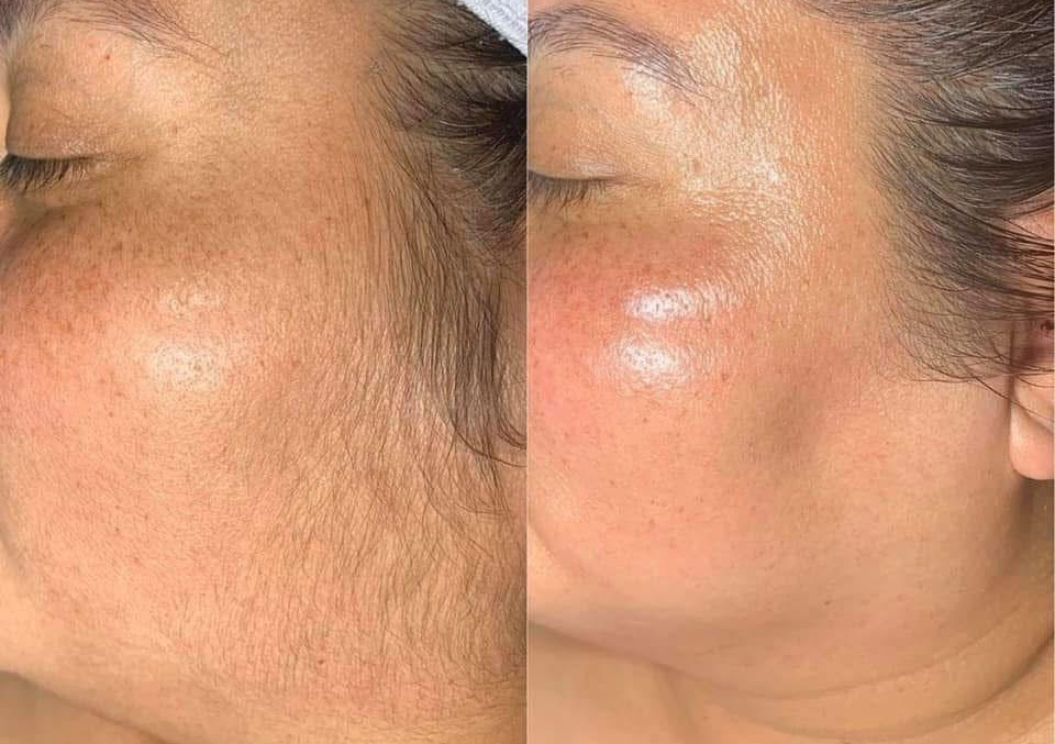 Content/Pre-paid Treatment