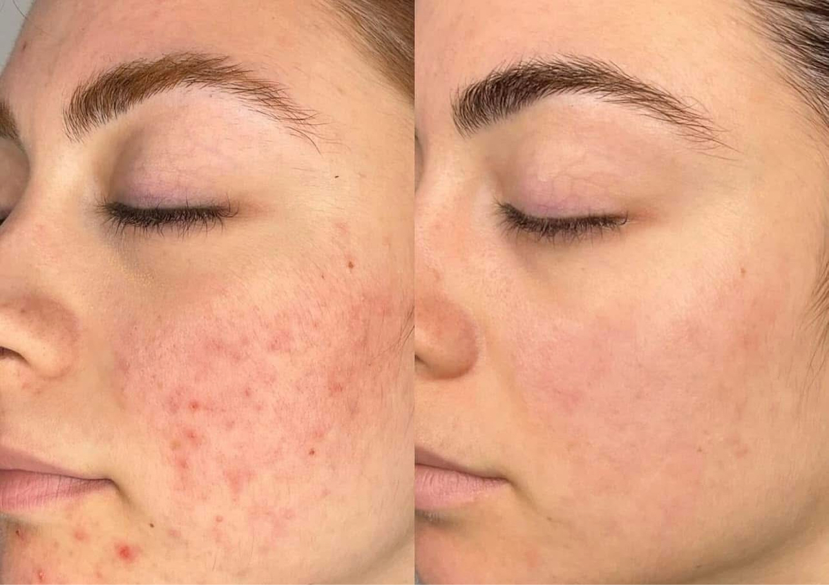 Skin Discovery Program