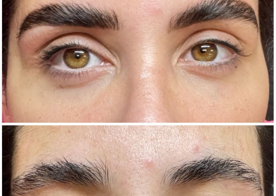 Brow Cleaning