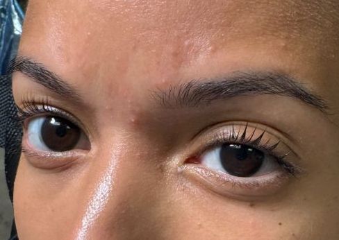 Lash Lift