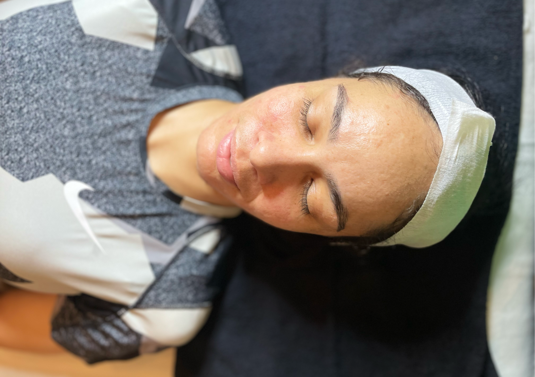 Ultra Bright Chemical Peel 