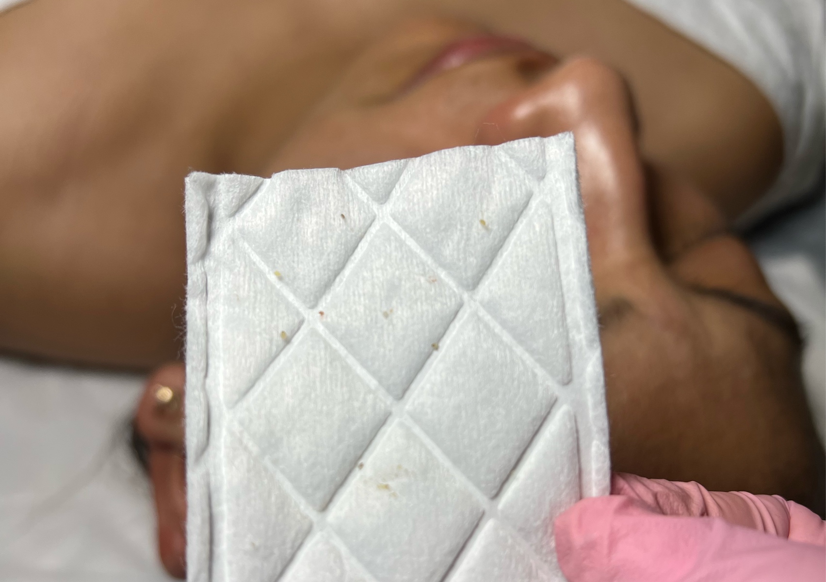 Classic Facial Treatment🧖‍♀️🫧