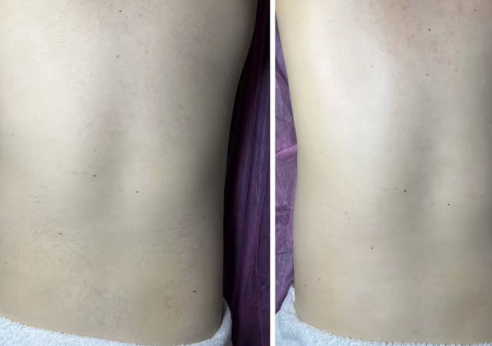 Back Wax (soft wax)