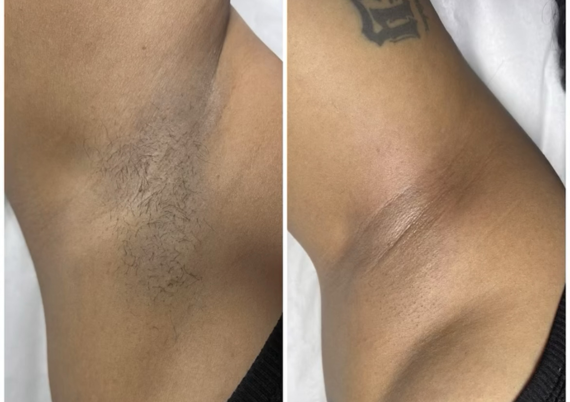 Under Arms Wax 