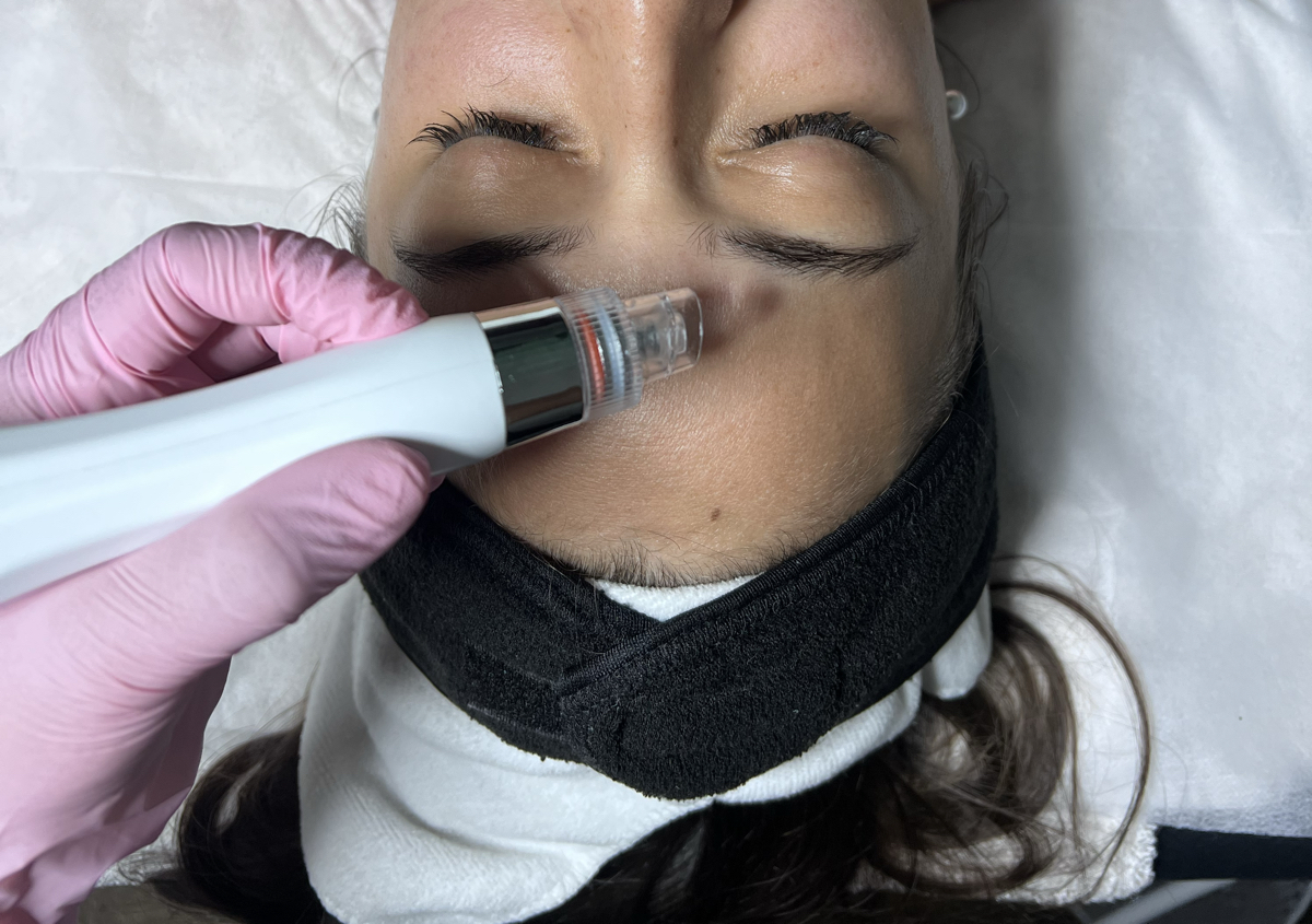 Hydrodermabrasion Deep Clean Facial 🪞✨