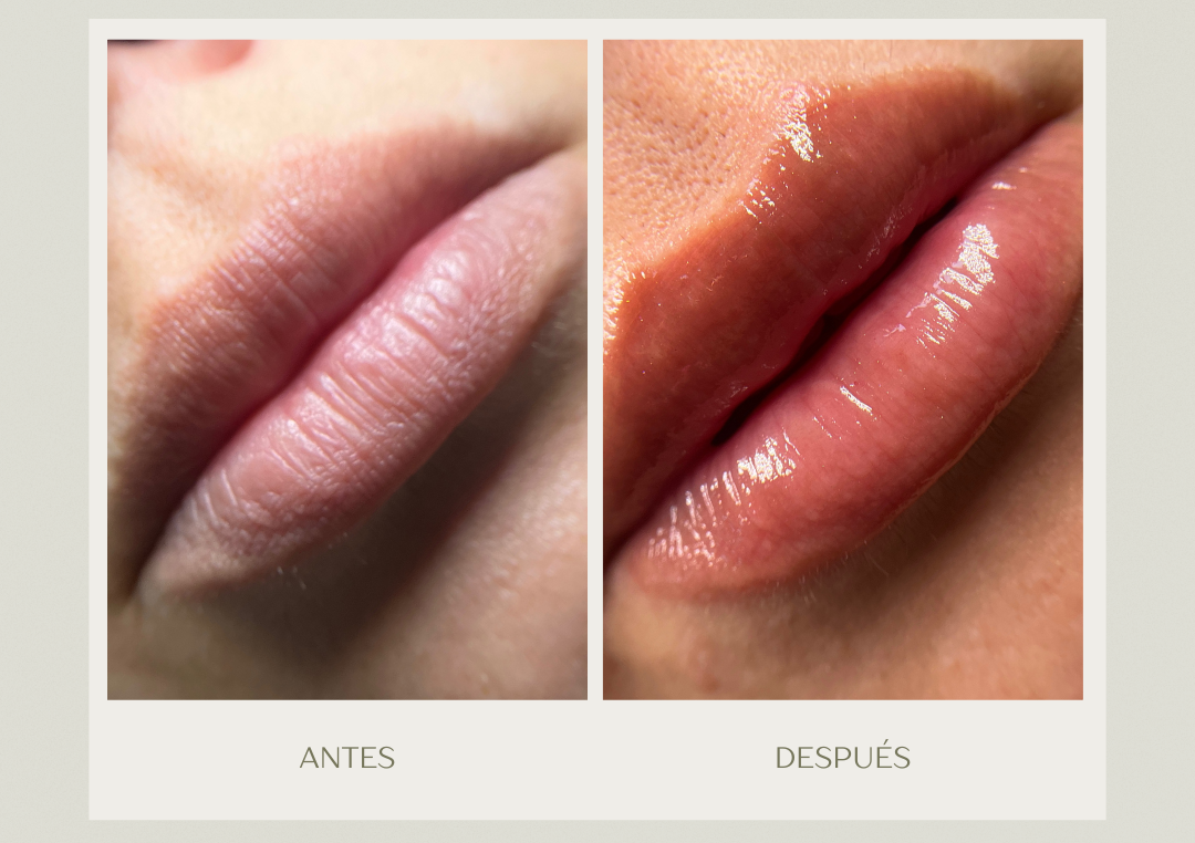 Hidratación Labial Profunda 