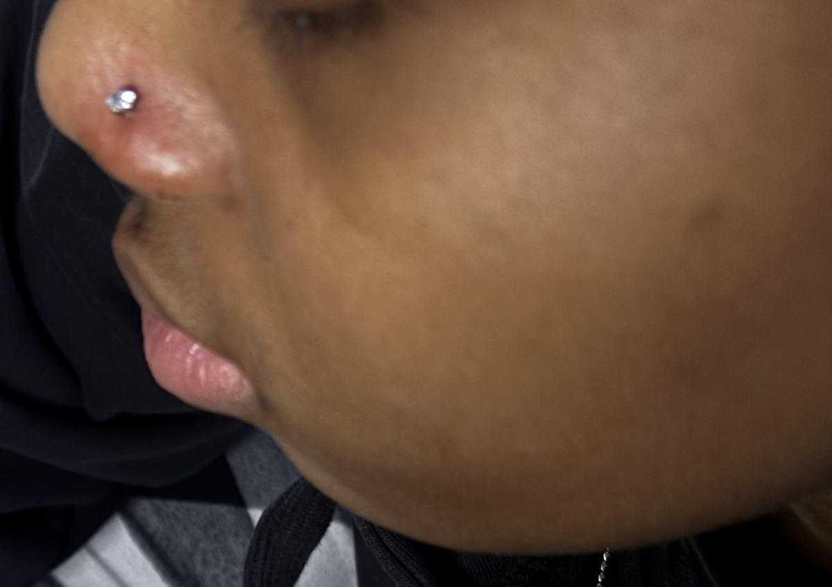 Nose (1)
