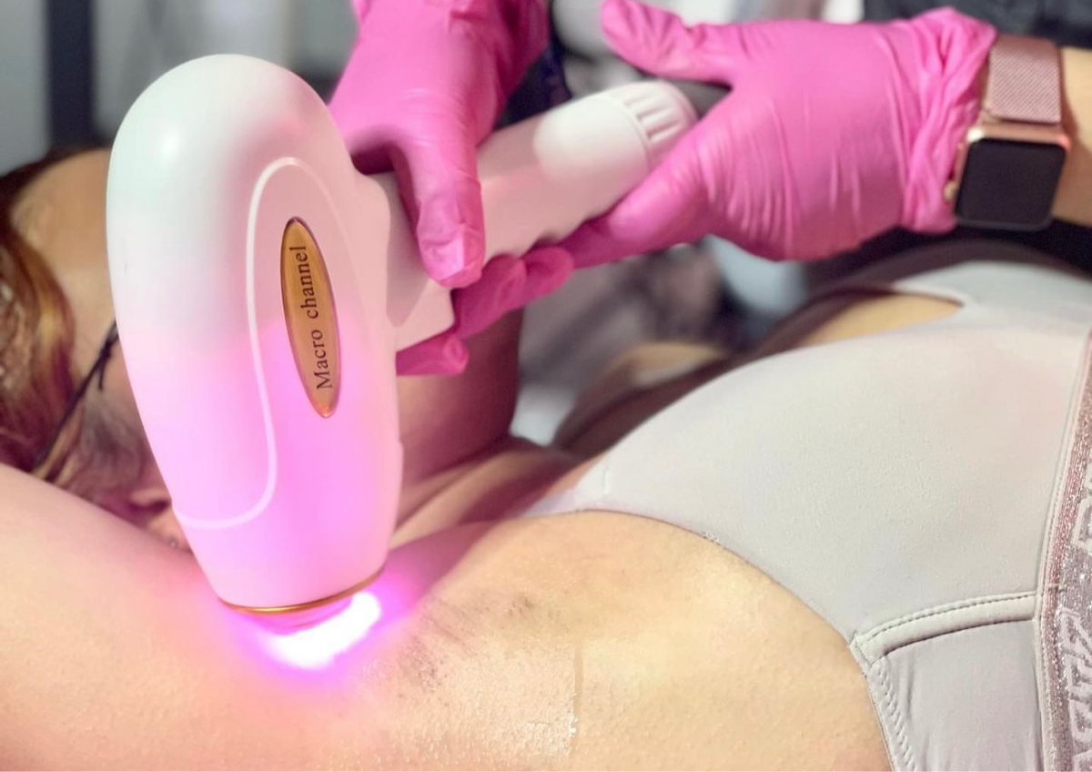 Paquete Axilas (5 secciones) 