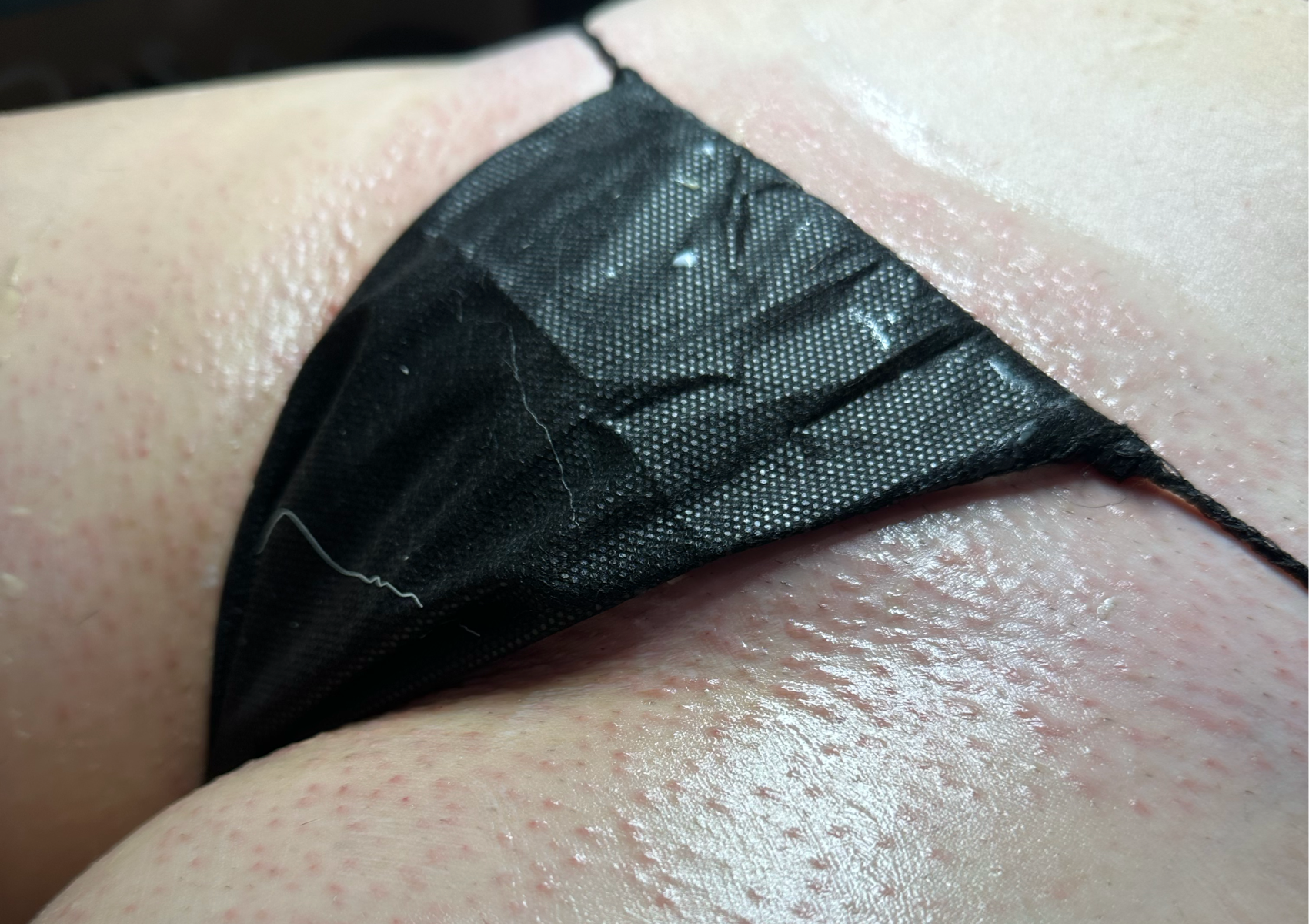 Depilación de Bikini-line