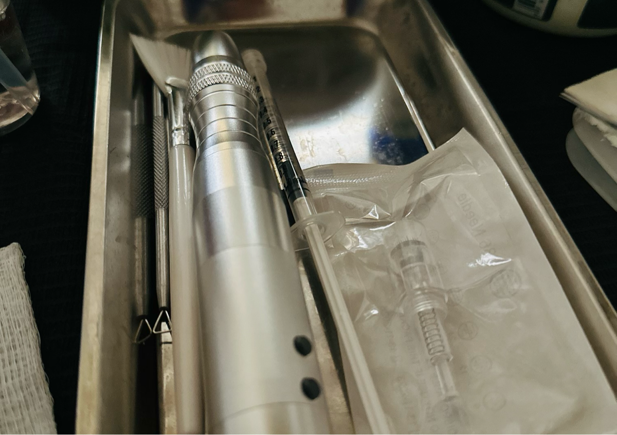 Limpieza Facial con Microagujas