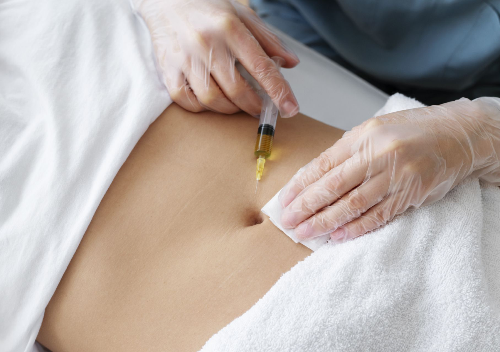 Mesoterapia Tradicional