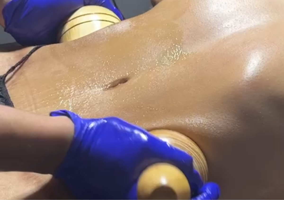 Paquete de Tratamiento Reductor/Marcación - abdomen o laterales