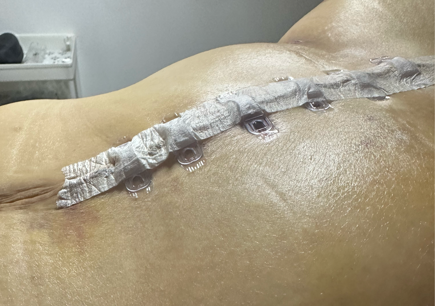 Masaje Post Operatorio Individual