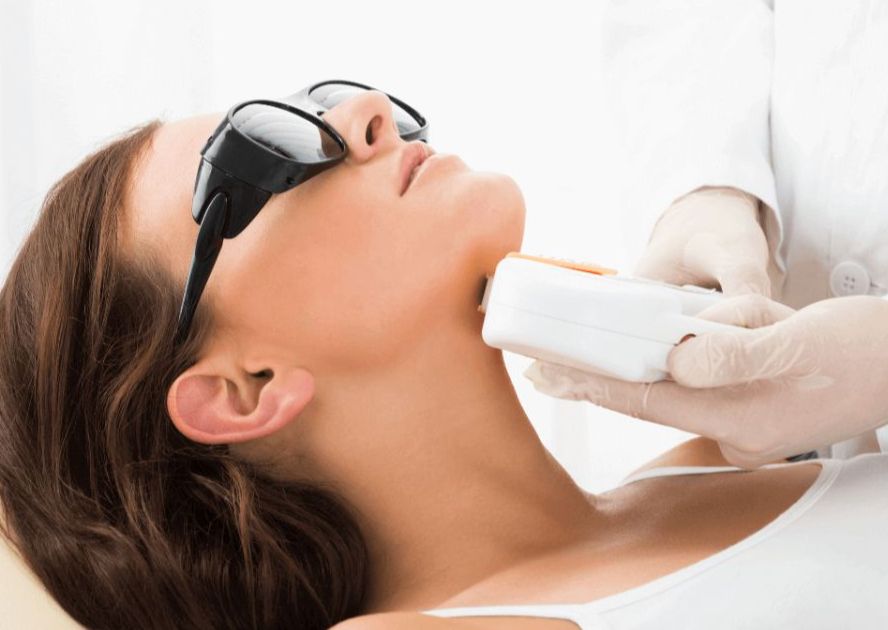 Depilación Facial Mentón