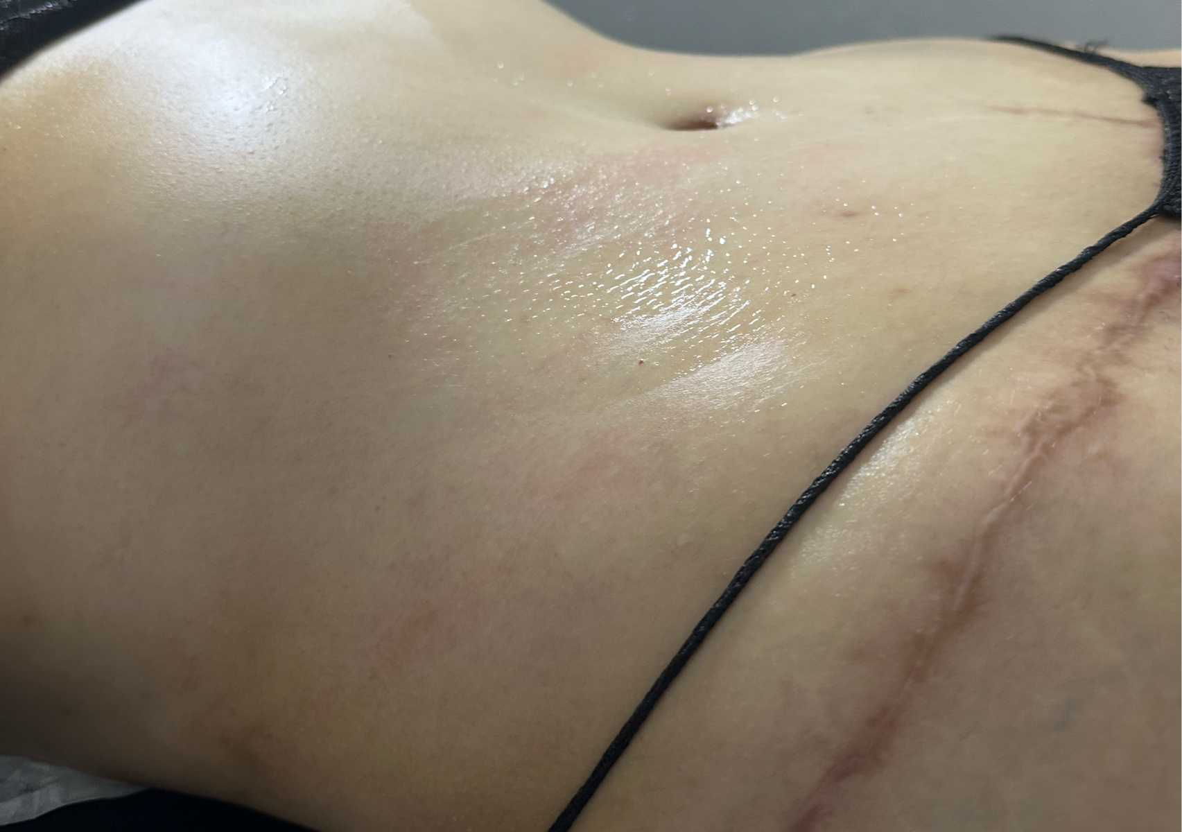 Post Operatorio Domicilio