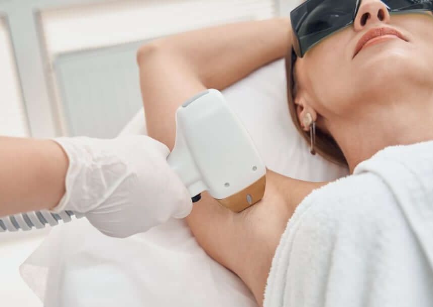 Depilación de Axilas Laser