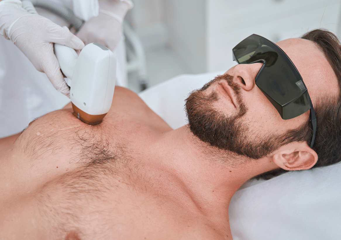 Depilación De Pecho Completo para Hombres - 1 Sesión 