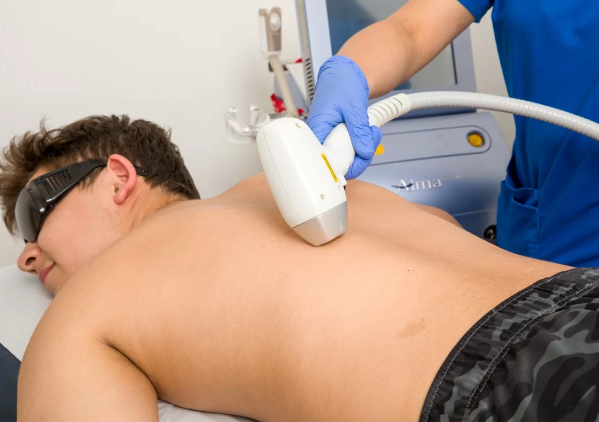 Depilación De Media Espalda - 1 Sesión 