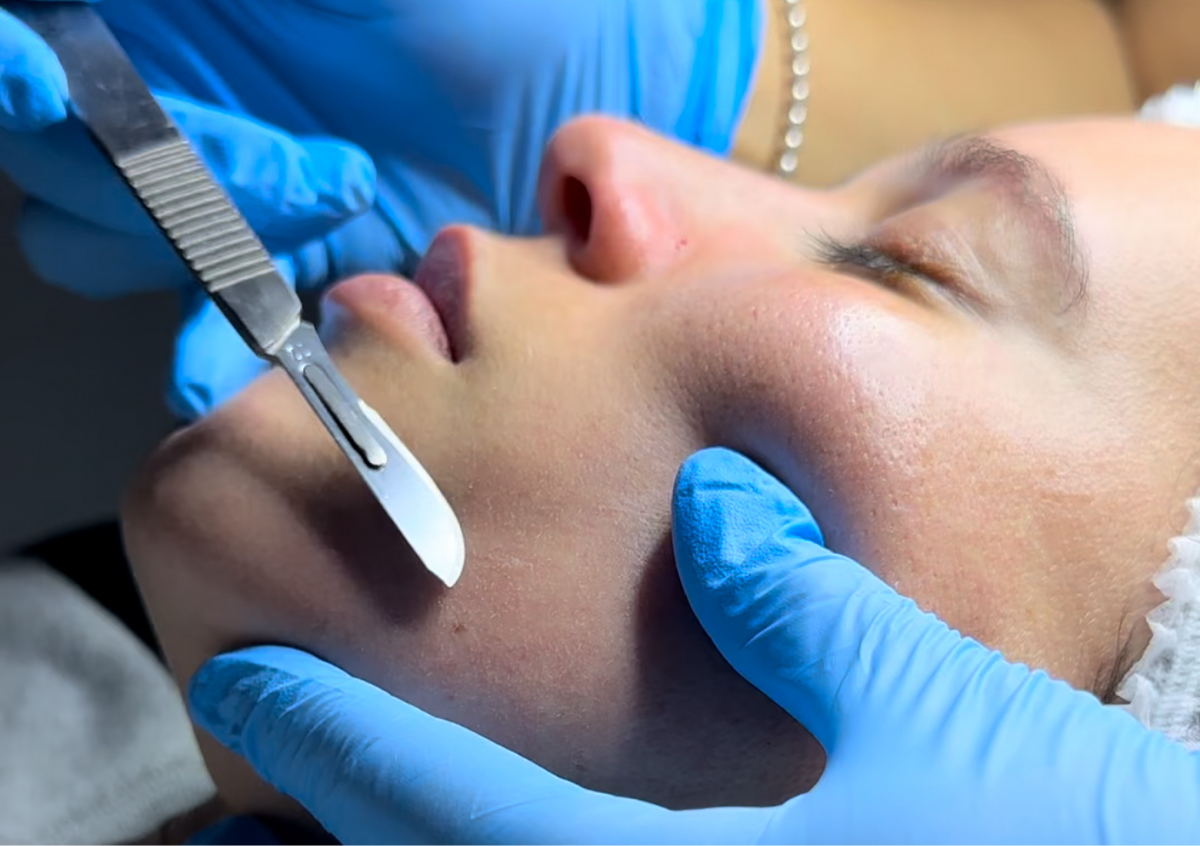 Limpieza Facial con Dermaplaning