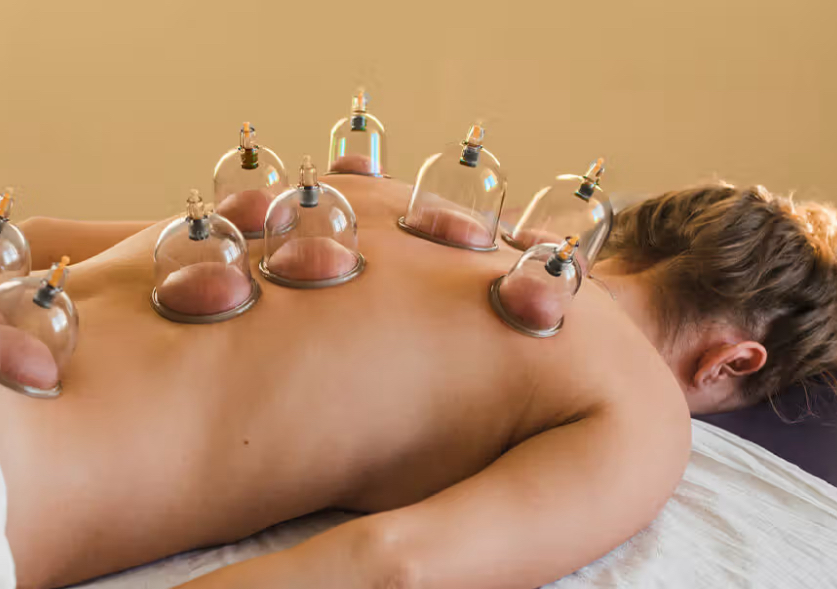 Cupping with Massage 60