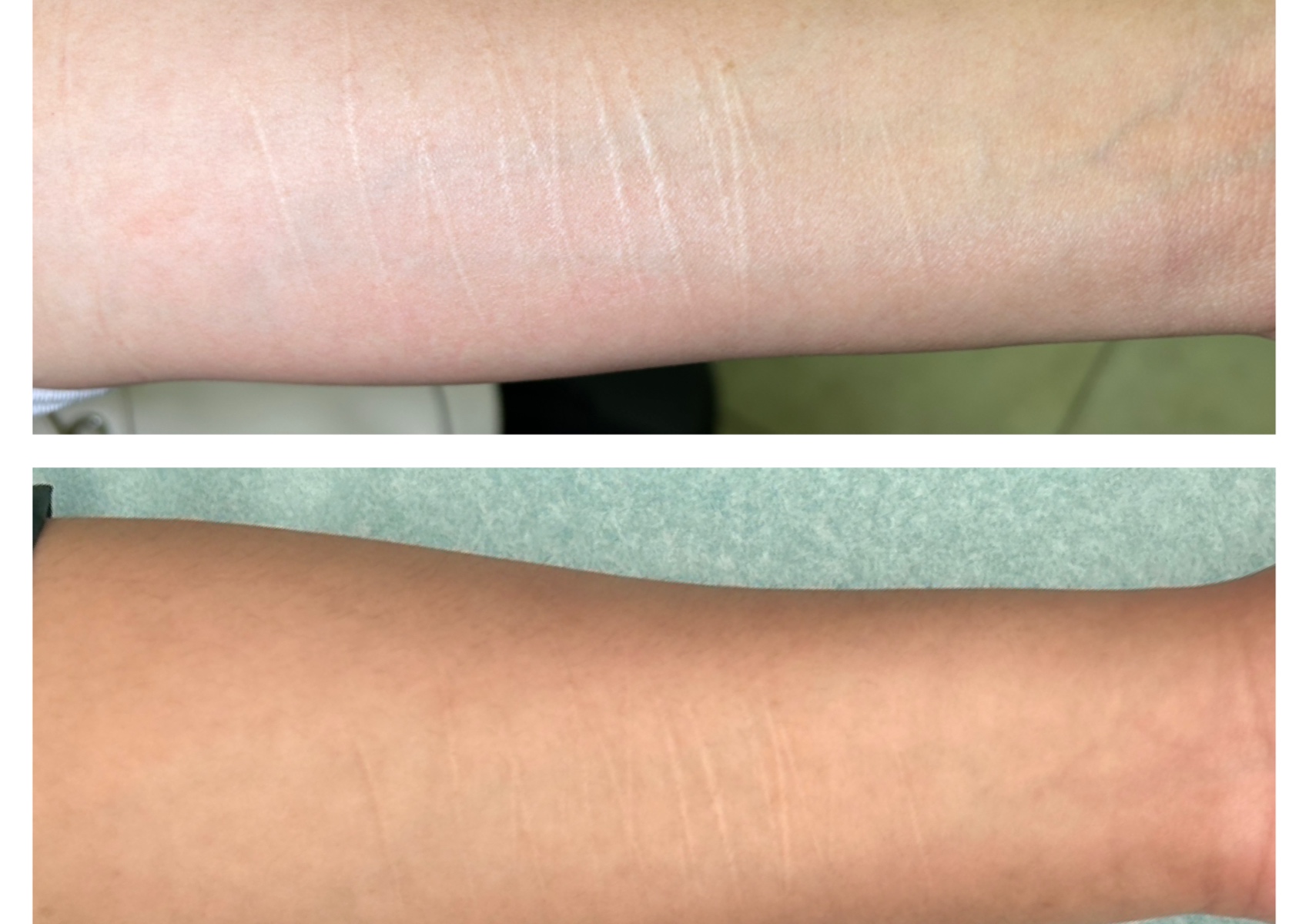 Consult - Scar Camouflage 