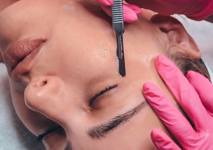 Dermaplaning 