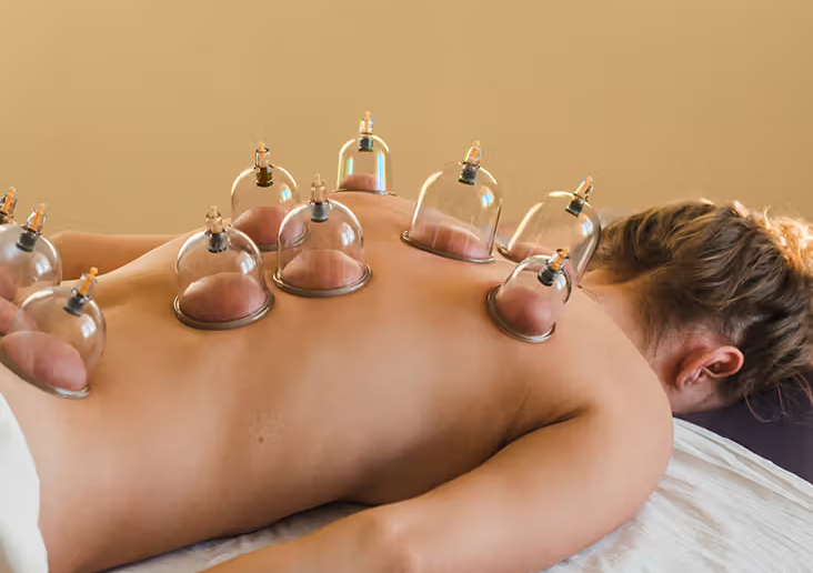 Cupping