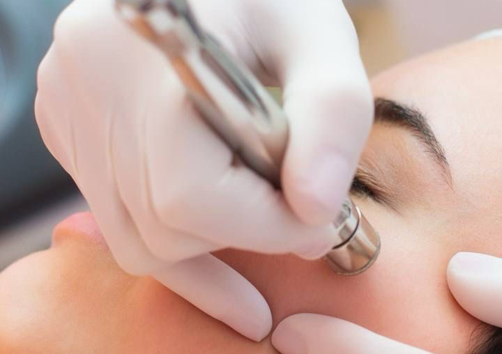 Diamond Glow Treatment ( Microdermabrasion) 