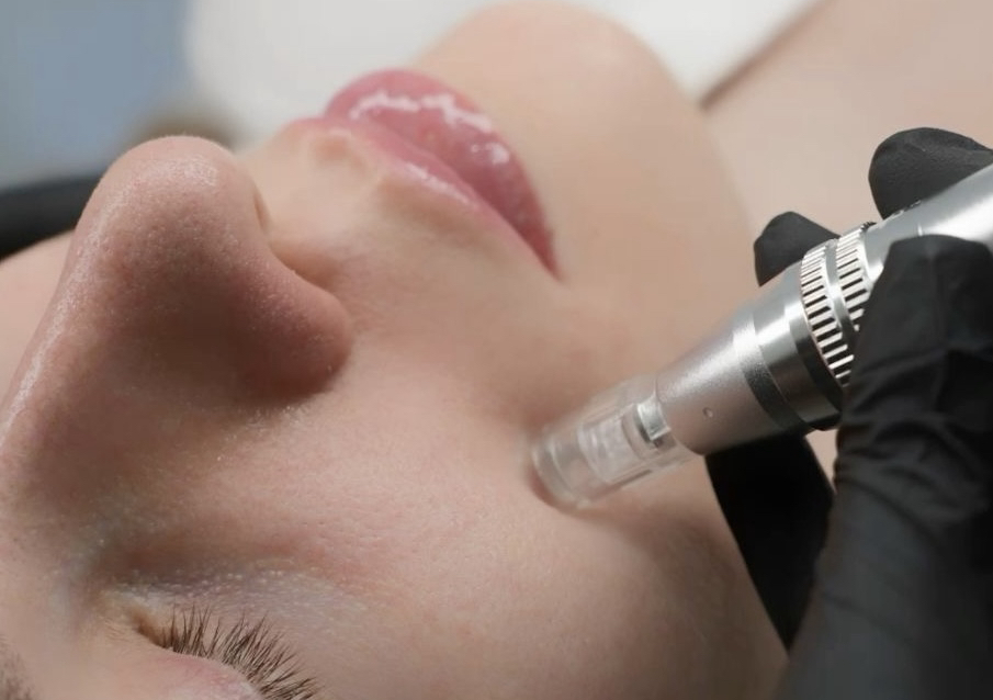 👑  Premium Glow Facial (Dermapen y ADN de Salmón) 