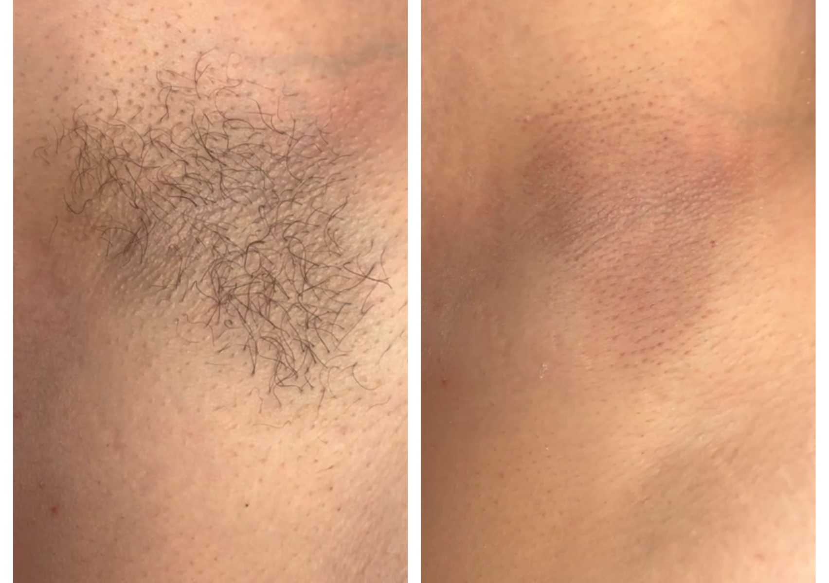 Permission to take BEFORE and AFTER photos