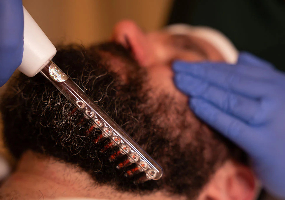 Beard Treatment