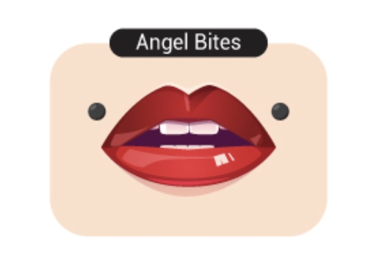 Angel Bites Lip Piercing