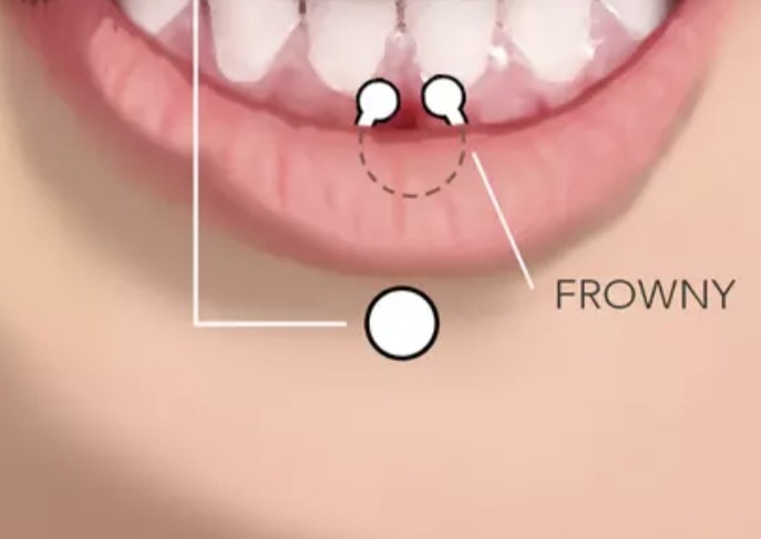 Frowny Piercing