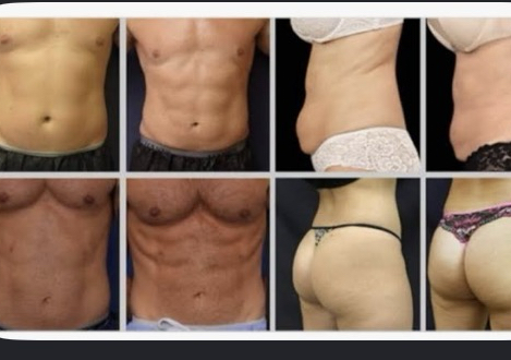 EMS Weightloss/Tuning Sculpting 