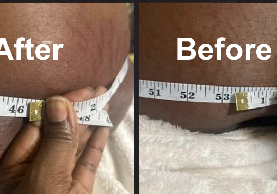 Ultrasonic Cavitation, Body Sculpting,& Lymphatic Massage package