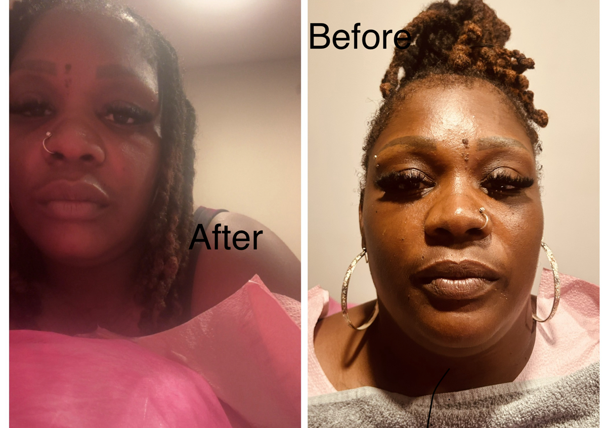 Face Sculpting 
