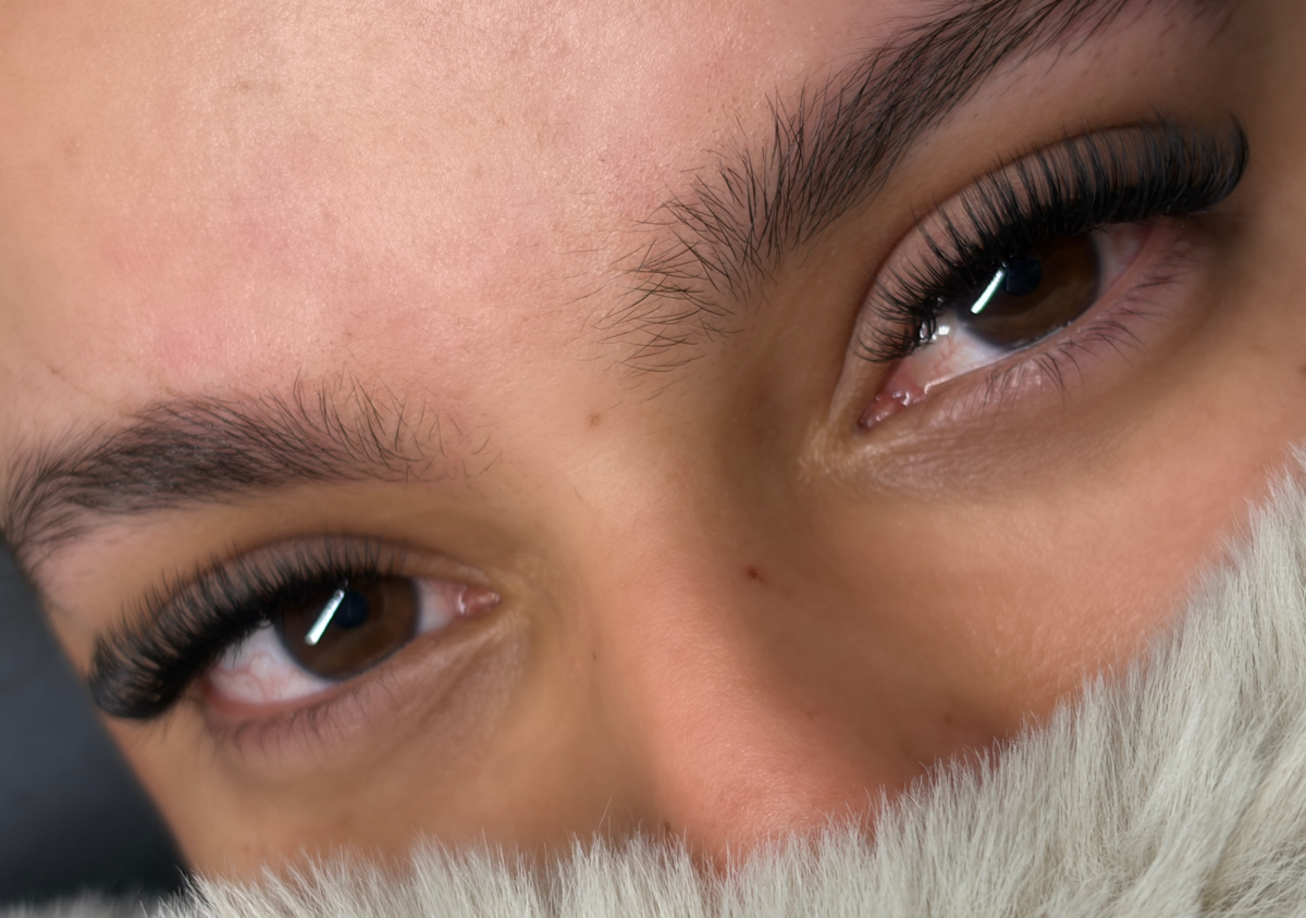 Volumen U Efecto Lifting 