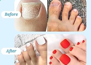 Magic Toenails Fixed 