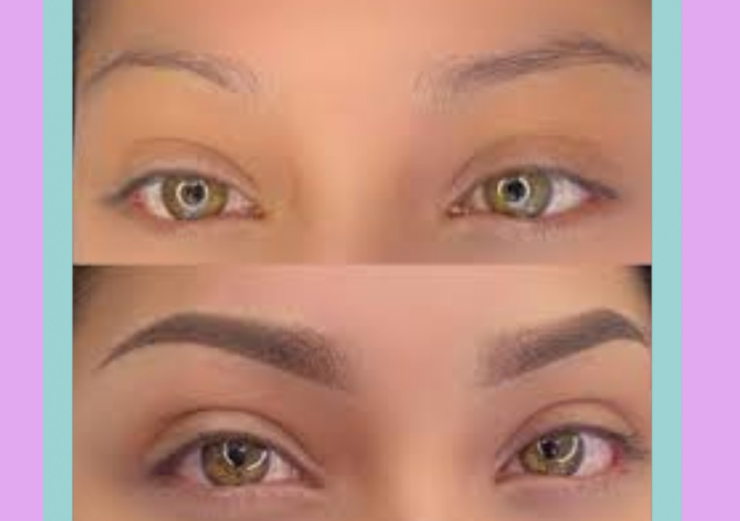 Retouch  4-7 weeks (My Client)