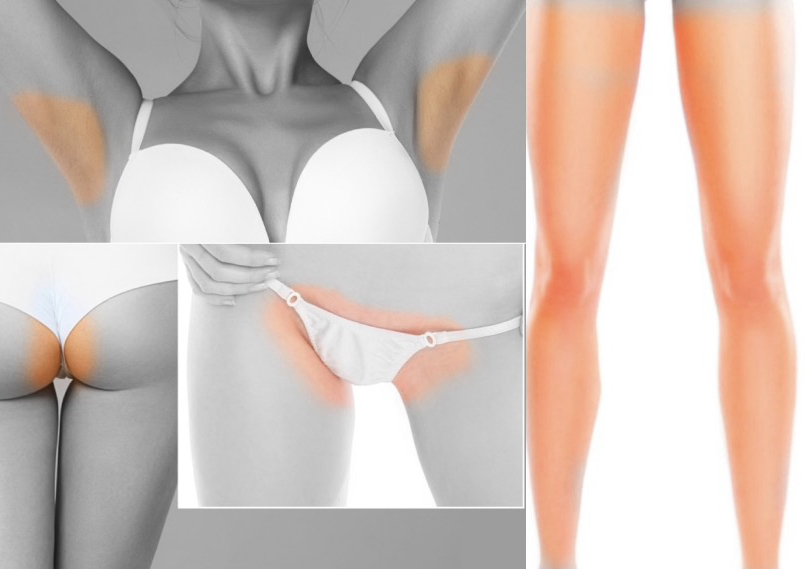 Toes, Full legs, Full Brazilian, belly line, underarms 