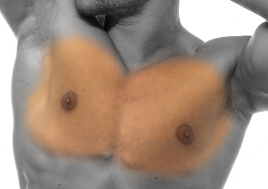Chest 